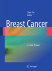 Image for Breast cancer: a lobar disease