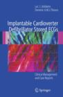Image for Implantable Cardioverter Defibrillator Stored ECGs : Clinical Management and Case Reports