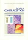 Image for A Slide Atlas of Contraception