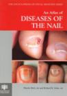 Image for An Atlas of Diseases of the Nail