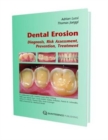 Image for Dental Erosion