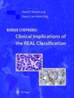 Image for Human lymphoma  : clinical implications of the REAL classification