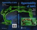 Image for Hypermobility of Joints