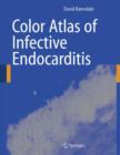 Image for Color Atlas of Infective Endocarditis