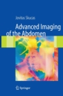 Image for Advanced Imaging of the Abdomen
