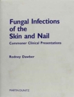 Image for Fungal Infections of the Skin and Nail: slide atlas