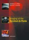 Image for Imaging of the Scrotum &amp; Penis