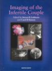Image for Imaging of the Infertile Couple