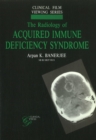 Image for Radiology of Acquired Immune Deficiency Syndrome