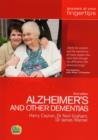 Image for Alzheimer&#39;s and other Dementias