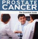 Image for Prostate cancer  : the essential guide
