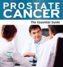 Image for Prostate Cancer: The Essential Guide