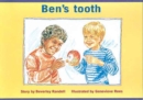 Image for Ben&#39;s tooth