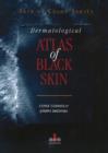 Image for Dermatological Atlas of Black Skin