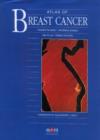Image for Atlas of Breast Cancer