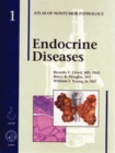 Image for Endocrine Diseases