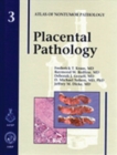 Image for Placental Pathology