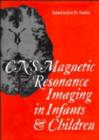 Image for CNS Magnetic Resonance Imaging in Infants and Children