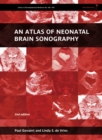 Image for An atlas of neonatal brain sonography