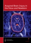 Image for Acquired Brain Injury in the Fetus and Newborn