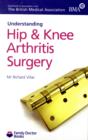 Image for Understanding Hip &amp; Knee Arthritis Surgery