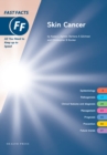 Image for Fast Facts: Skin Cancer