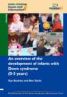 Image for An Overview of the Development of Infants with Down Syndrome (0-5 Years)