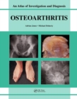 Image for Osteoarthritis  : atlas of investigation diagnosis and management