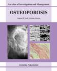 Image for Osteoporosis  : an atlas of investigation and diagnosis