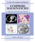 Image for Lymphoid Malignancies
