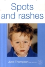 Image for Spots and Rashes