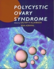 Image for Polycystic ovary syndrome