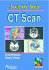 Image for CT Scan