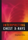 Image for Interpreting chest x-rays