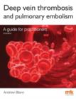Image for Deep Vein Thrombosis and Pulmonary Embolism: A Guide for Practitioners