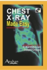 Image for Chest X-Ray Made Easy