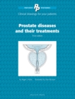 Image for Patient Pictures: Prostate diseases and their treatments