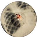 Image for X Ray Audio