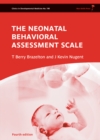 Image for Neonatal Behavioral Assessment Scale