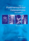 Image for Atlas of postmenopausal osteoporosis