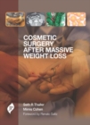 Image for Cosmetic Surgery after Massive Weight Loss
