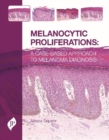Image for Melanocytic Proliferations
