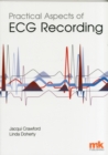 Image for Practical aspects of ECG recording