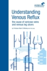 Image for Understanding venous reflux  : the cause of varicose veins and venous leg ulcers