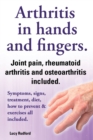 Image for Arthritis in hands and arthritis in fingers. Rheumatoid arthritis and osteoarthritis included. Symptoms, signs, treatment, diet, how to prevent &amp; exercises all included.