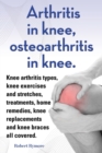 Image for Arthritis in knee, osteoarthritis in knee. Knee arthritis types, knee exercises and stretches, treatments, home remedies, knee replacements and knee braces all covered.
