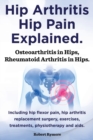 Image for Hip Arthritis, Hip Pain Explained. Osteoarthritis in Hips, Rheumatoid Arthritis in Hips. Including Hip Arthritis Surgery, Hip Flexor Pain, Exercises,