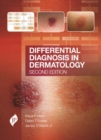 Image for Differential diagnosis in dermatology