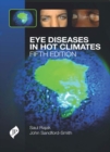 Image for Eye diseases in hot climates