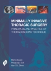 Image for Minimally invasive thoracic surgery
